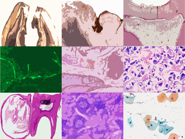 口腔病理基本画像アトラス