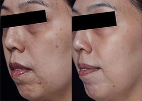 ZX-CLINIC【公式】｜大阪梅田・北新地からすぐの安くて承認機使用の