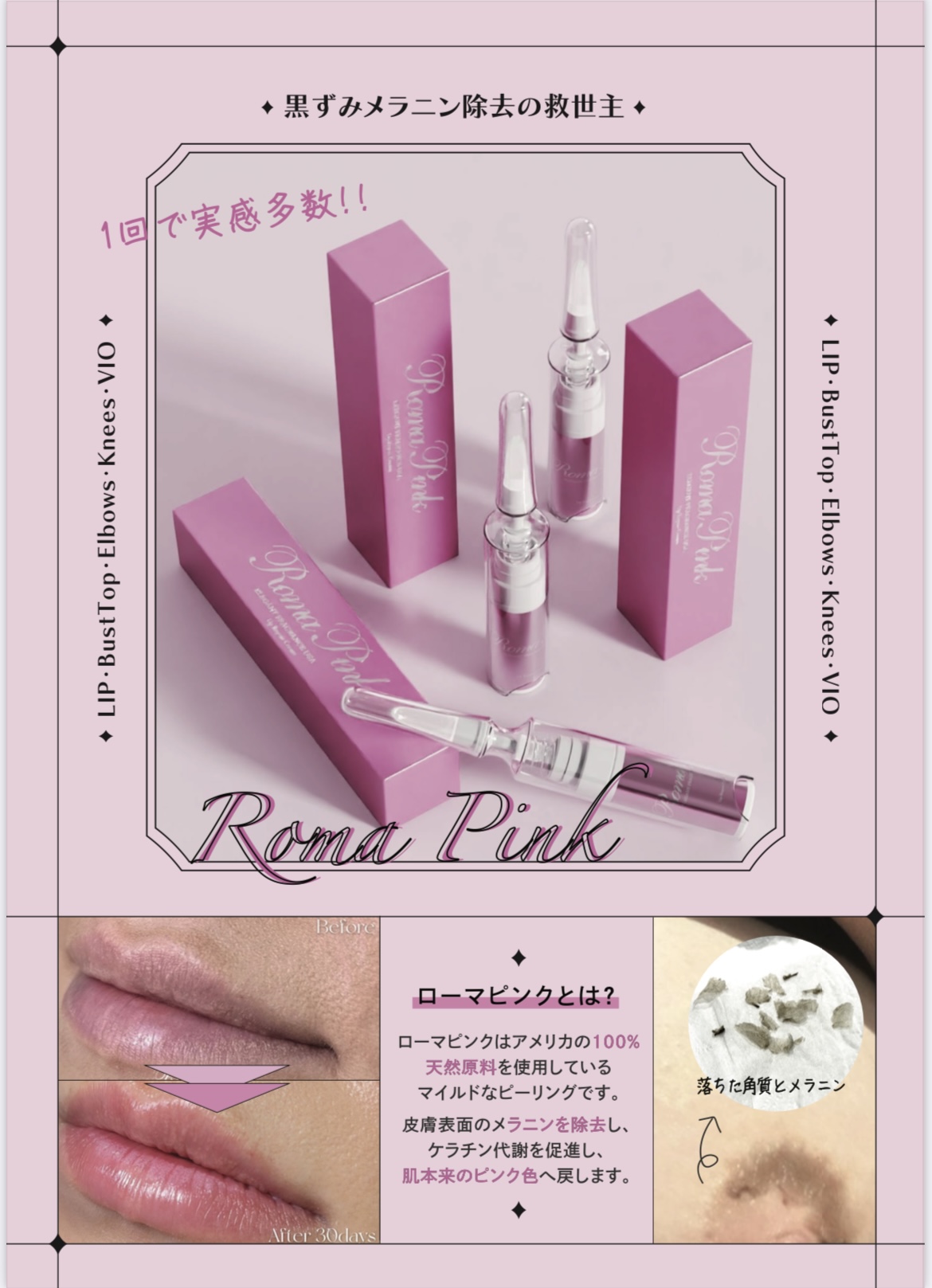 RomaPink（ローマピンク）メラニンケア