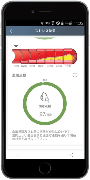 スマートパルス（SmartPluse） | 株式会社アスミテルジャパン