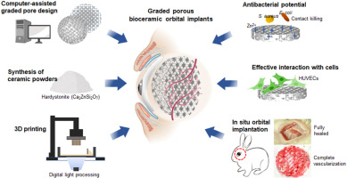 Next-generation finely controlled graded porous antibacterial