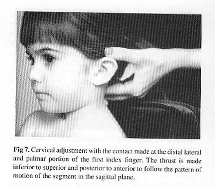 ADJUSTING THE PEDIATRIC SPINE