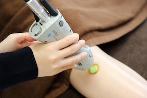 医療レーザー脱毛｜富山県高岡市 皮膚科ちえこクリニック