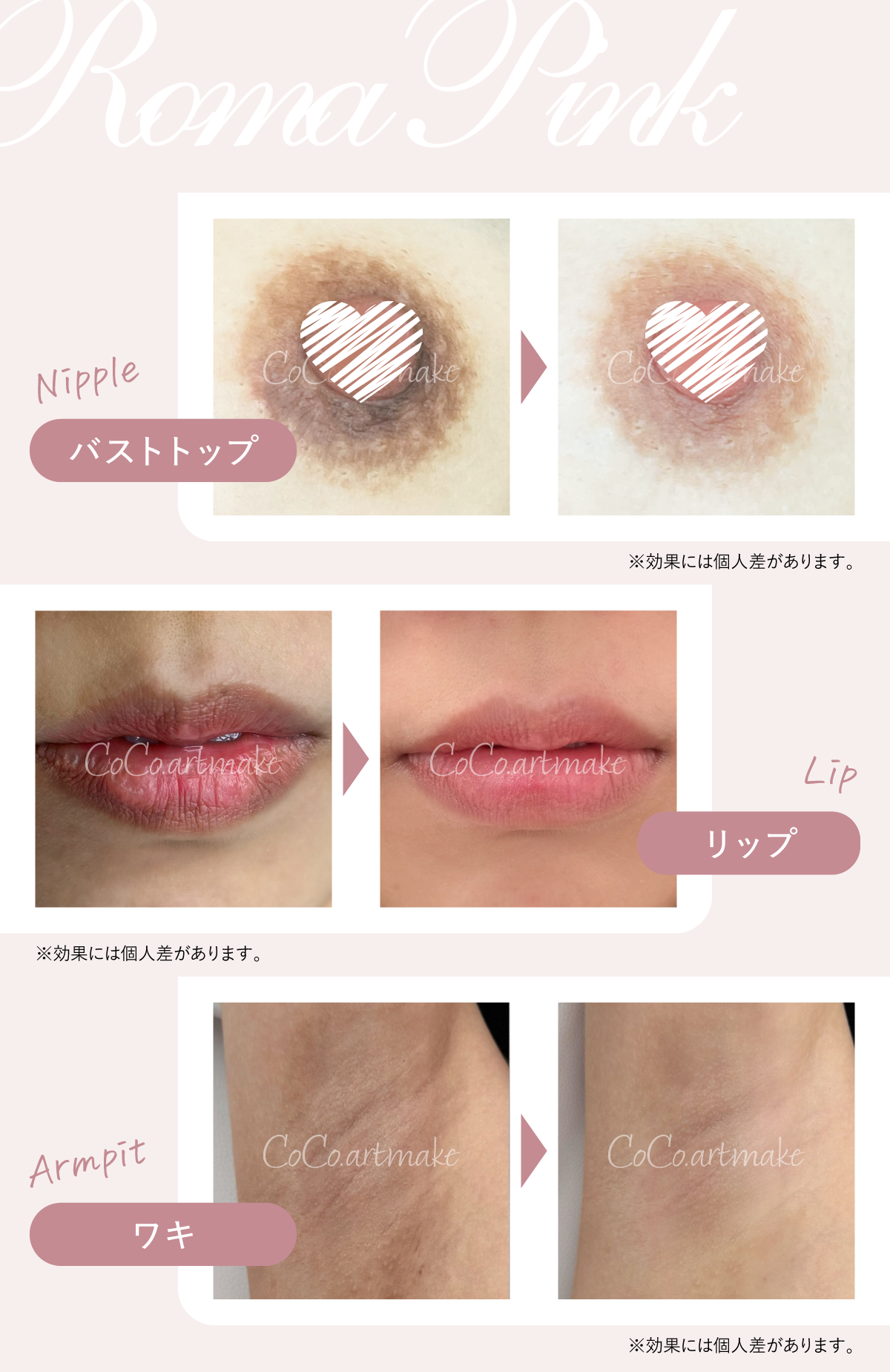 Roma Pink（ローマピンク）｜アートメイク専門クリニック｜CoCo