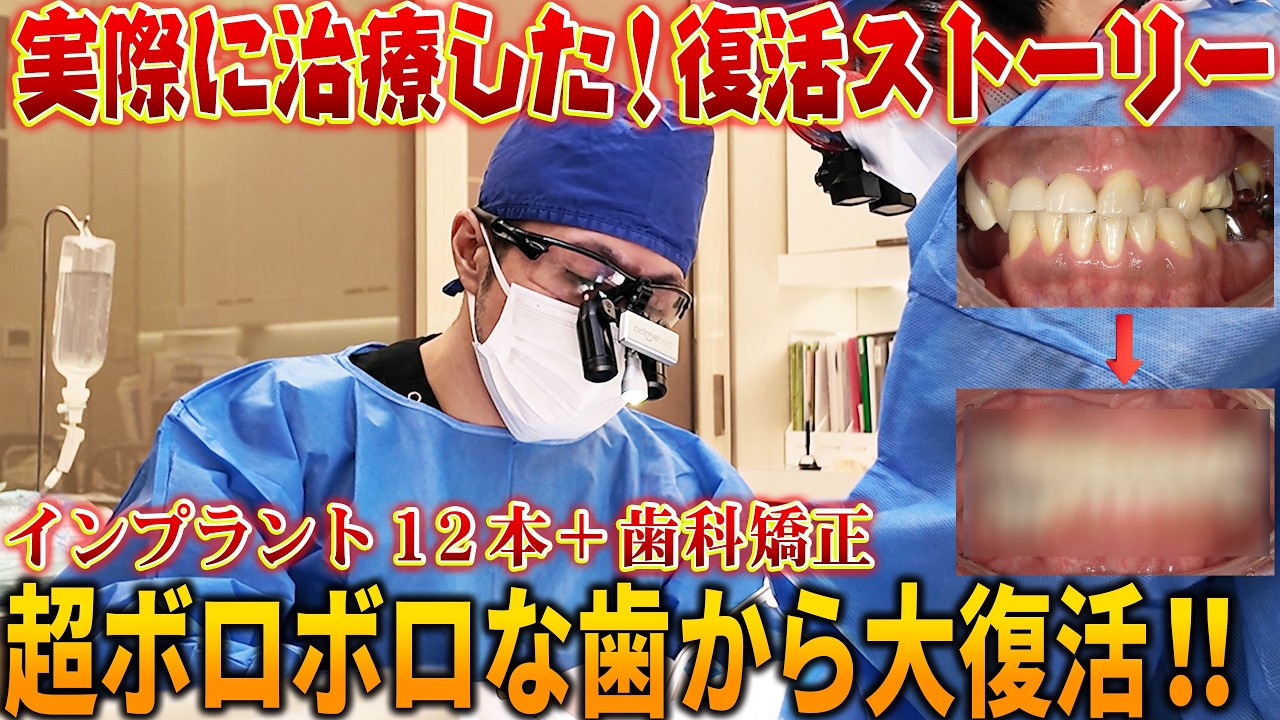 スリーステップ秋山メソッドBASIC授業Lesson5 #マイクロスコープ #秋山