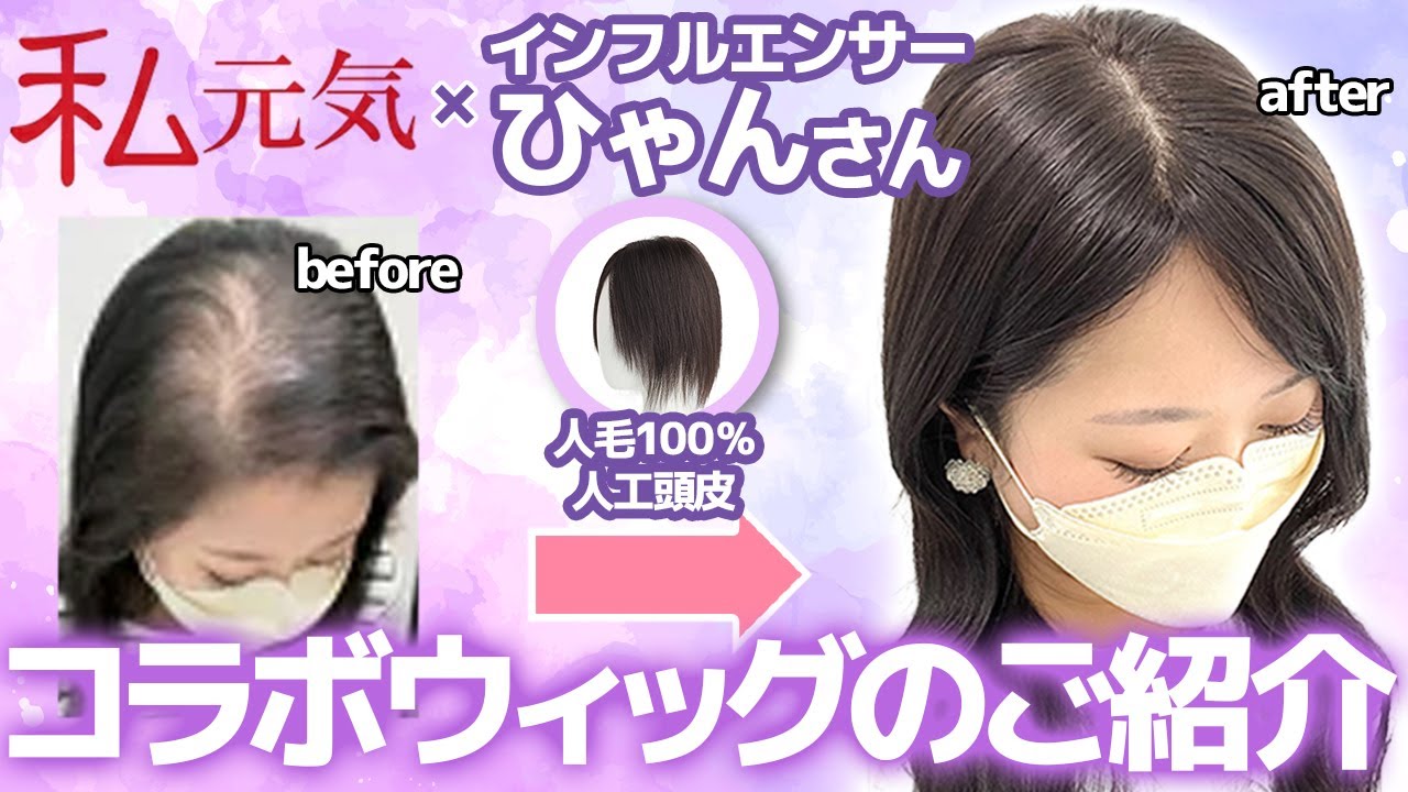 Introducing the partial wig [Igenki x Hyangsan collaboration