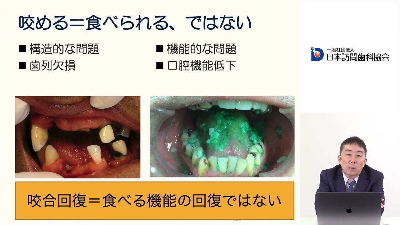 おいしく食べるための義歯・ケア・リハ – 株式会社デジタルクリエイト