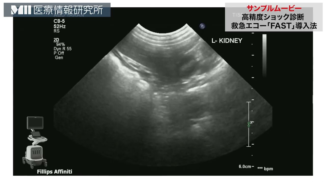 高精度ショック診断 救急エコー「FAST」導入法 | 医療情報研究所 DVD
