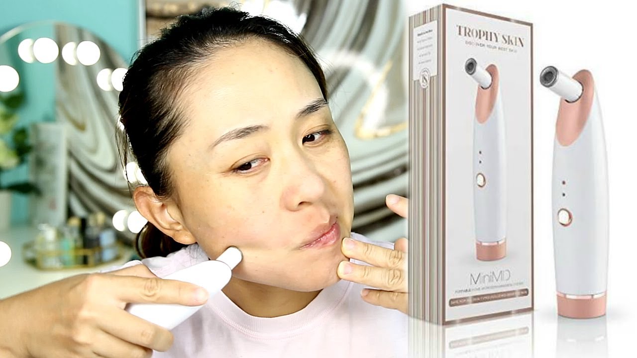 TROPHY SKIN MINIMD - MICRODERMABRASION SYSTEM REVIEW/FIRST
