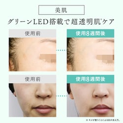 ヨドバシ.com - ステラボーテ STELLA BEAUTE IPL＆LED光美容器 ムダ毛