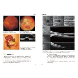 ●裁断済 最新 網膜循環疾患コンプリートガイド 最新 網膜循環疾患コンプリートガイド－所見・検査，疾患と診断・治療