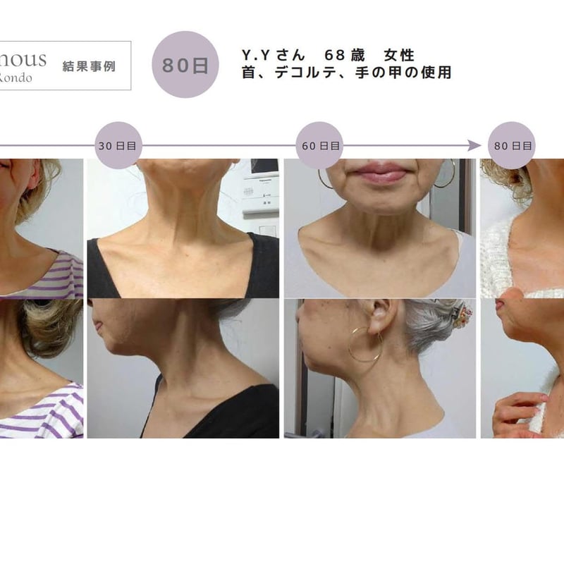 3ヶ月 定期便 15%オフ】[セインムー・ボーテロンド 100mL] 部分太り