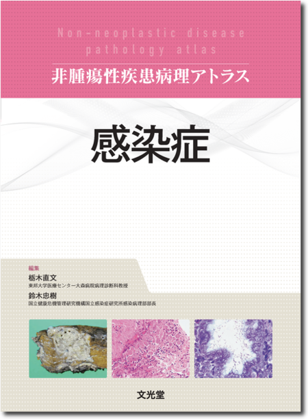 m3電子書籍 | 非腫瘍性疾患病理アトラス 肺