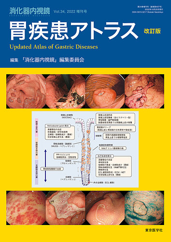 消化器内視鏡 22年34巻増刊号 (発売日2022年10月22日) | 雑誌/定期購読
