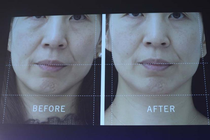 ルルドから、「筋肉博士」のワザを再現した美顔ローラーが登場 - 価格