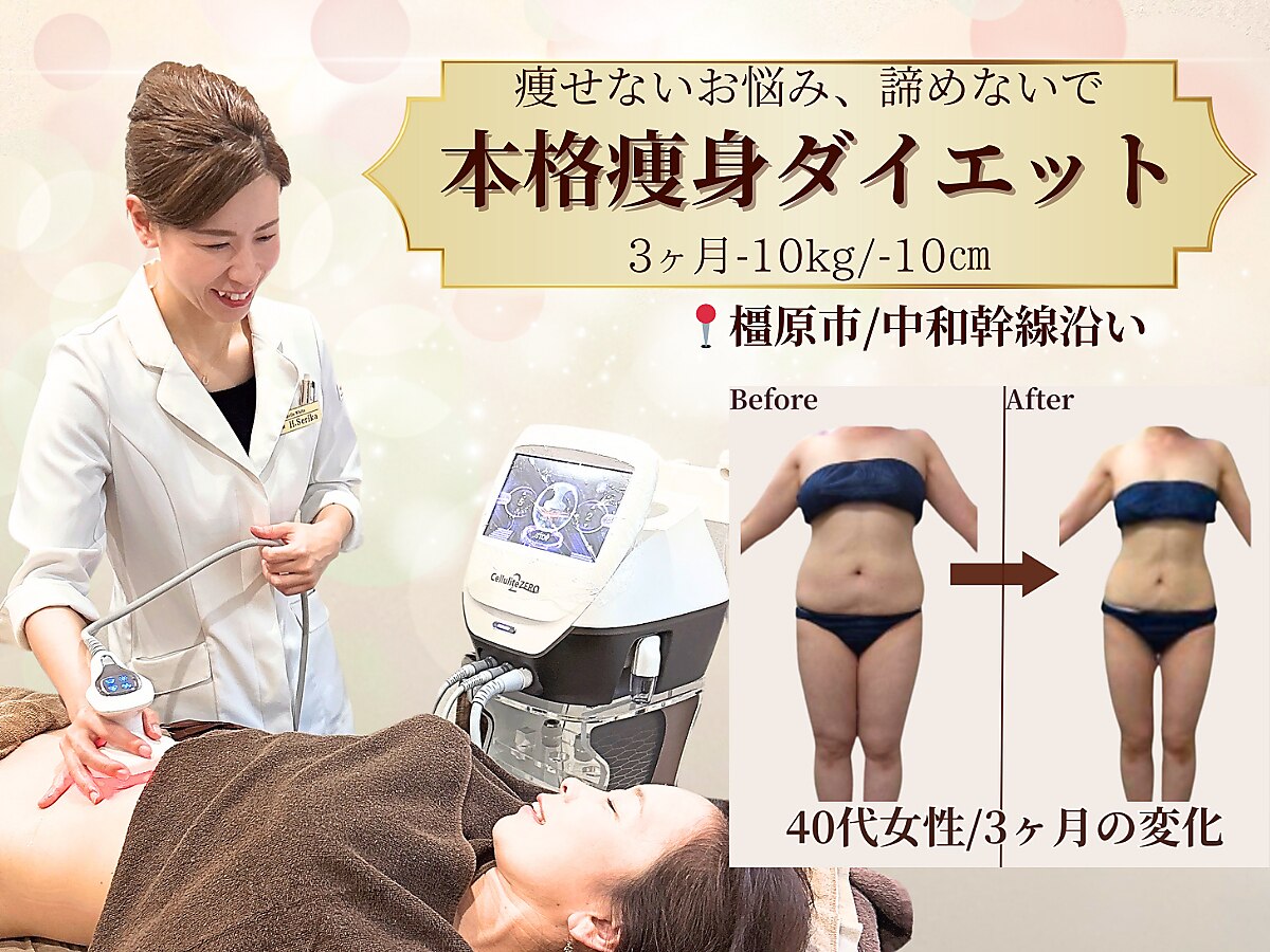 ベルホワイト(Belle White)｜ホットペッパービューティー