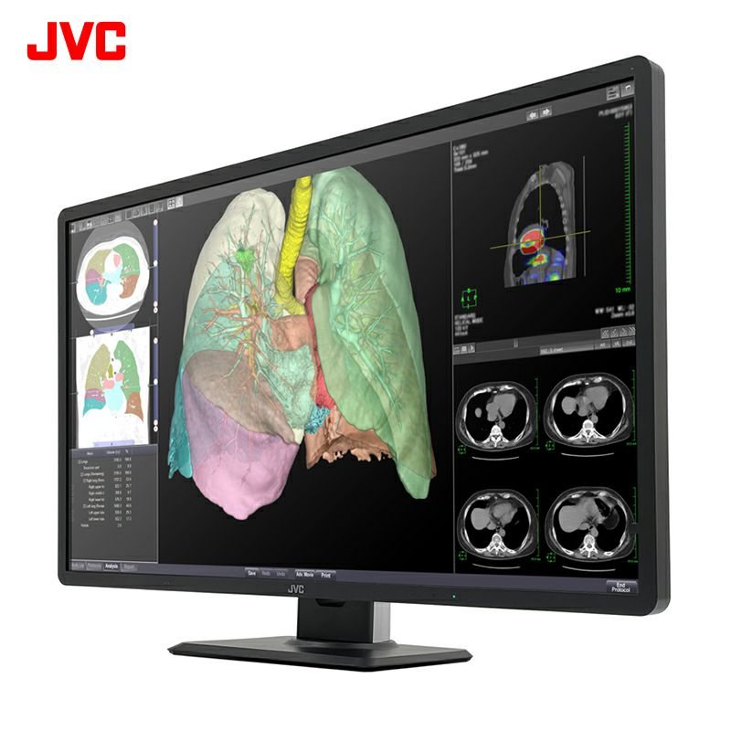 800万画素32型カラー液晶モニター JESRA X-0093(管理グレード1B)対応