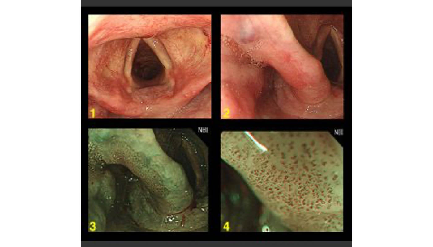 食道 – kozaki-clinic