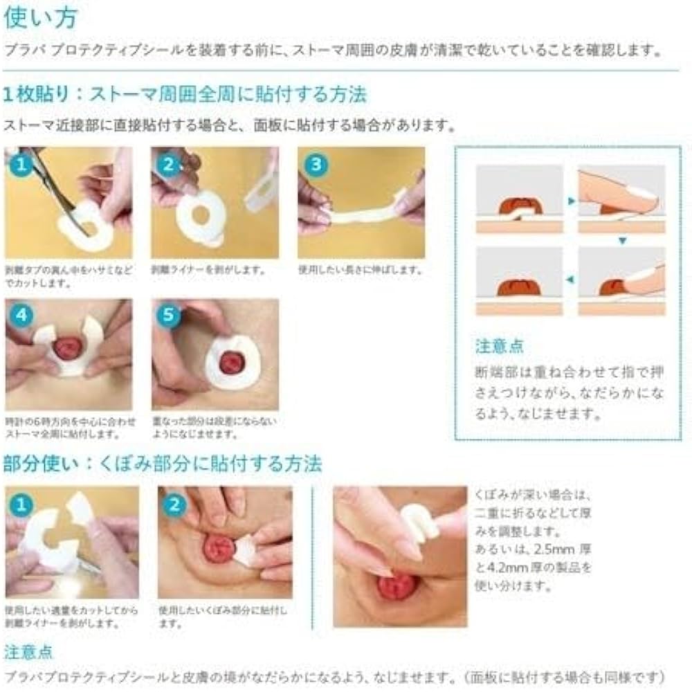 Amazon.co.jp: コロプラスト ブラバ プロテクティブシール 厚み2.5mm