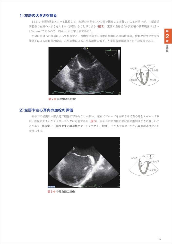 カラー写真で一目でわかる 経食道心エコー 第3版〜撮り方、診かたの