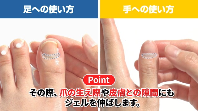 Amazon.co.jp: [指定医薬部外品] 爪 際まで浸透・密着 薬用ジェル