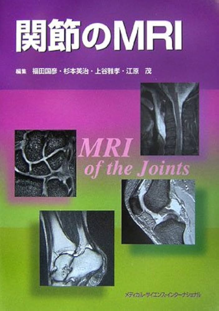 関節のMRI | 福田国彦 |本 | 通販 | Amazon
