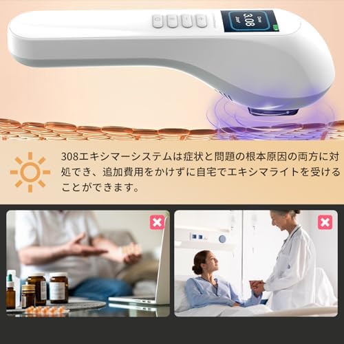 Amazon.co.jp: エキシマライト ナローバンド 光線 308ナローバンド