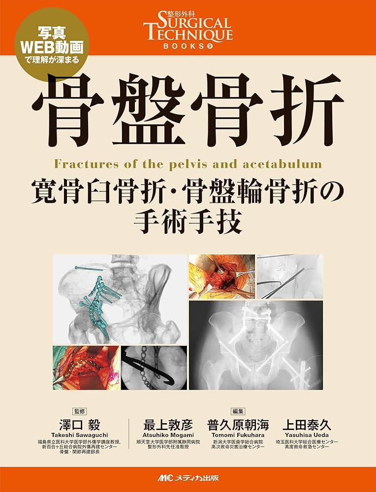骨盤骨折: 寛骨臼骨折・骨盤輪骨折の手術手技 (整形外科SURGICAL