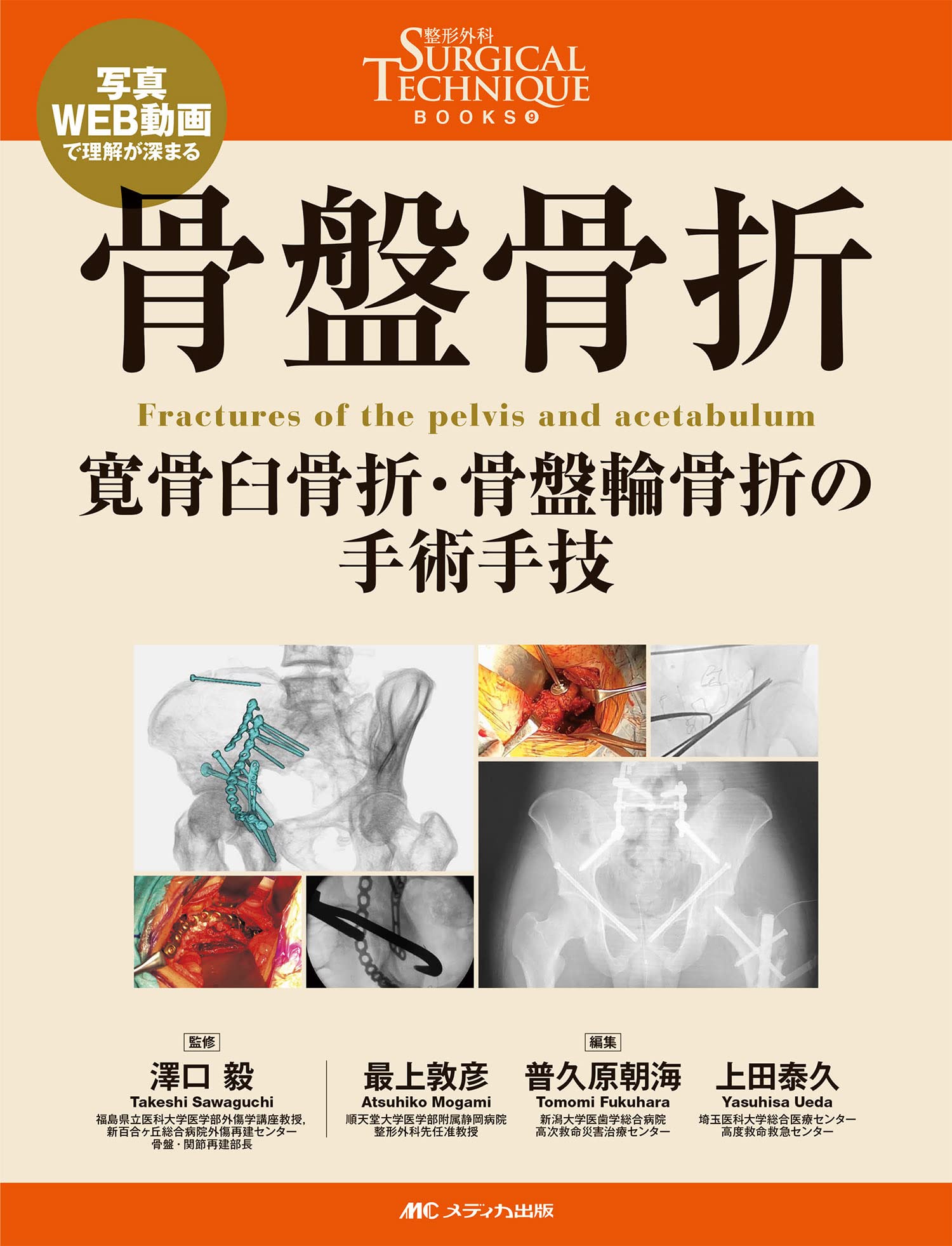 骨盤骨折: 寛骨臼骨折・骨盤輪骨折の手術手技 (整形外科SURGICAL
