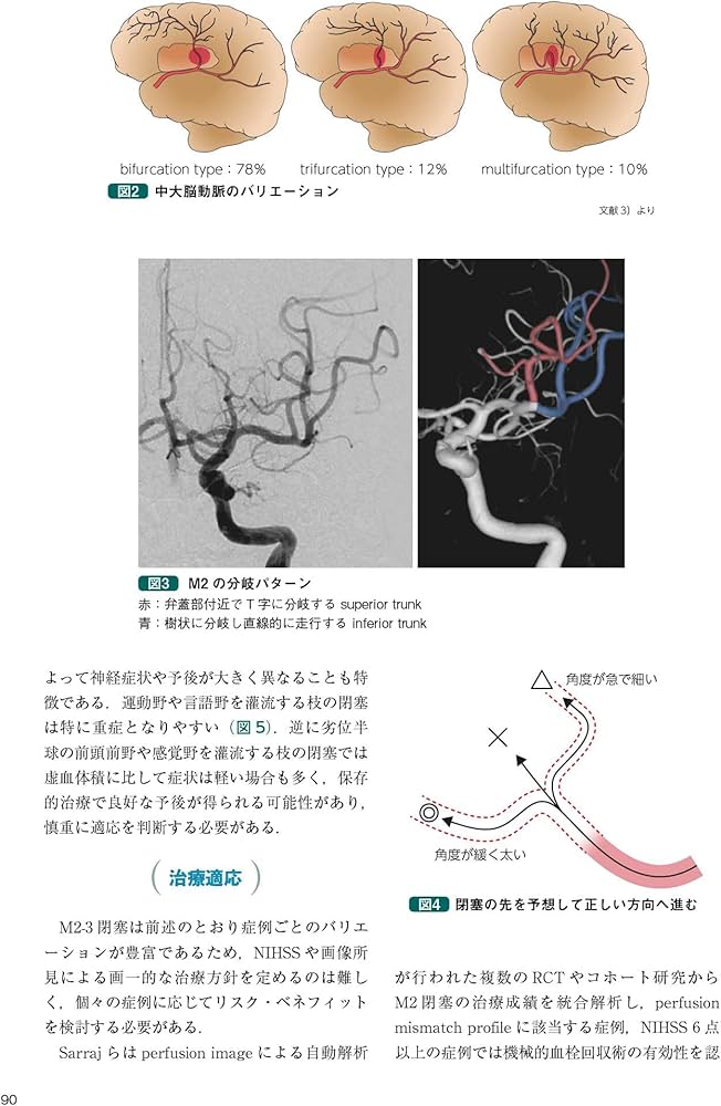 改訂2版 血栓回収療法Technical Tips：治療の引き出しを増やす！／手技