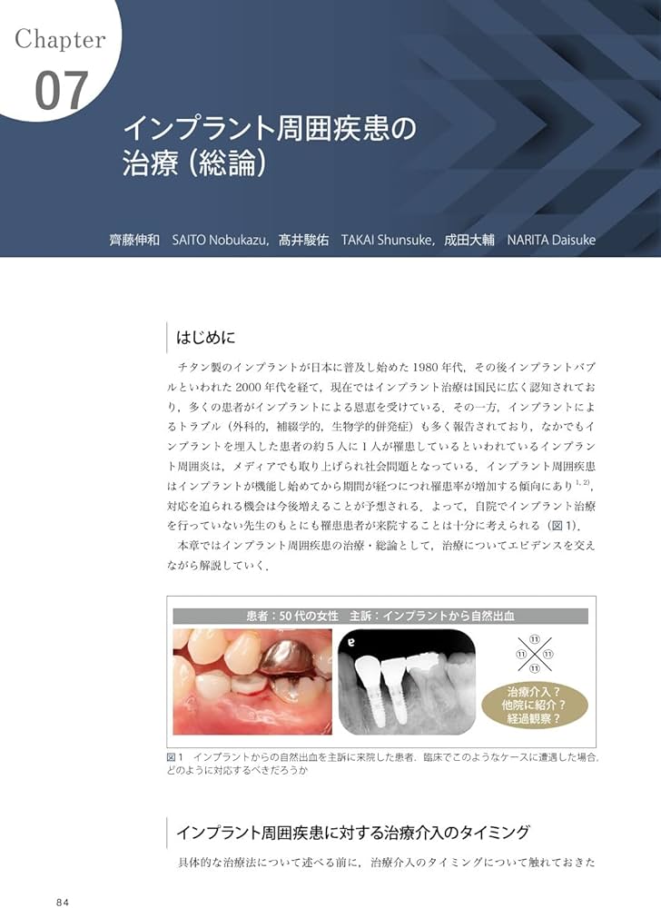 Amazon.co.jp: インプラント周囲疾患のすべて: Textbook of Peri