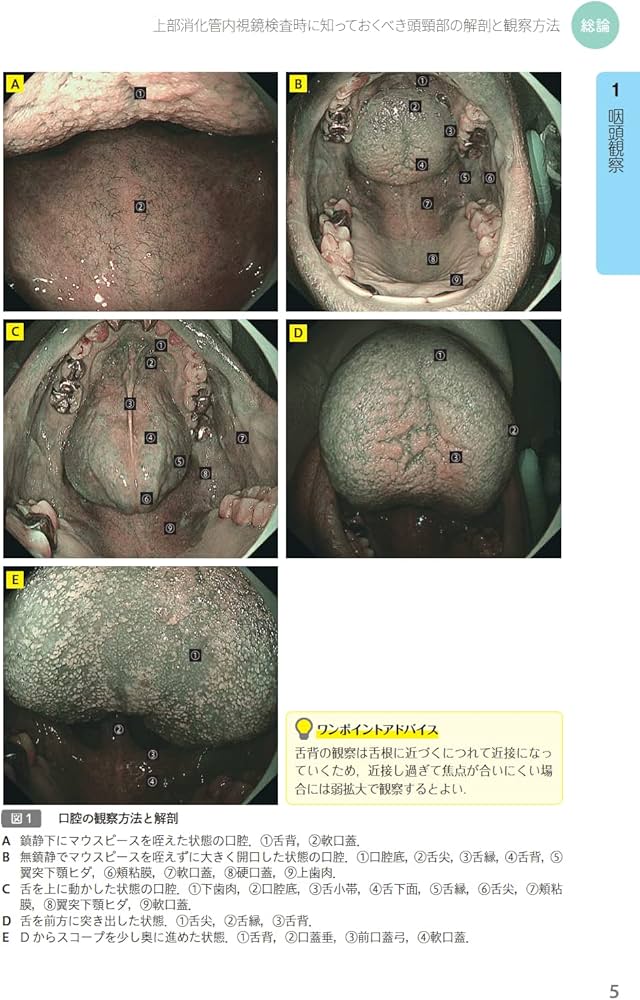こんなときどうする!? 食道癌・咽頭癌 内視鏡の達人たちによる診断と