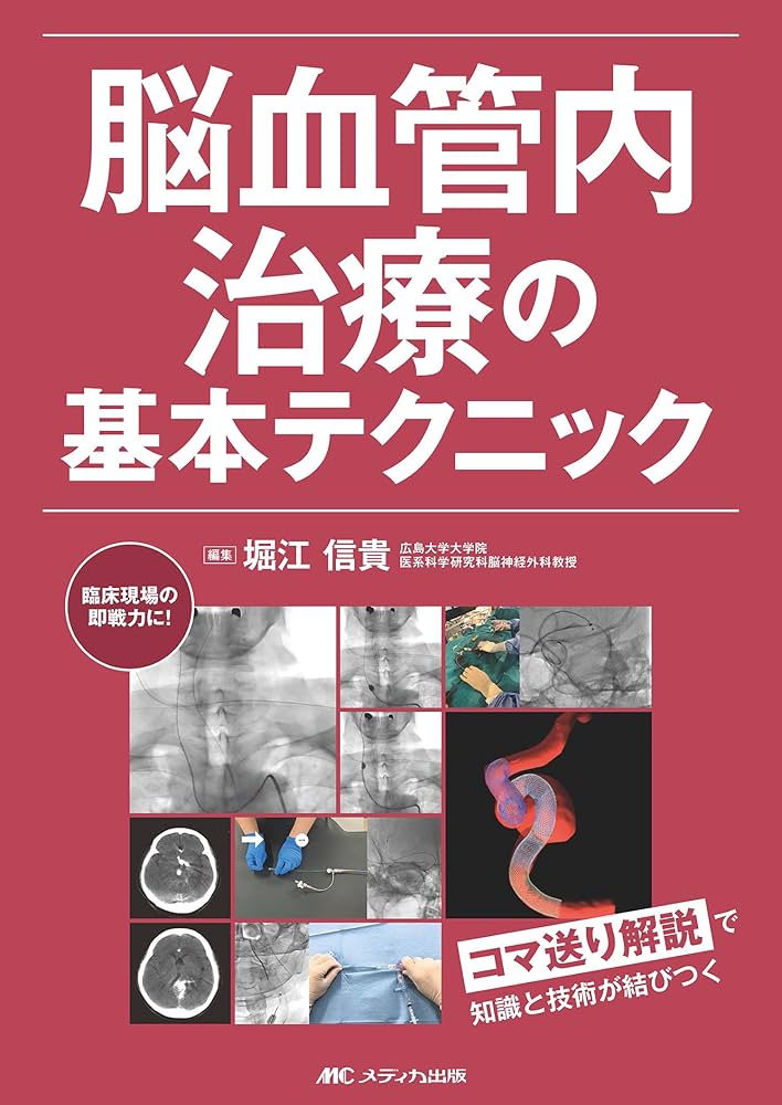 脳血管内治療の基本テクニック：コマ送り解説で知識と技術が結びつく