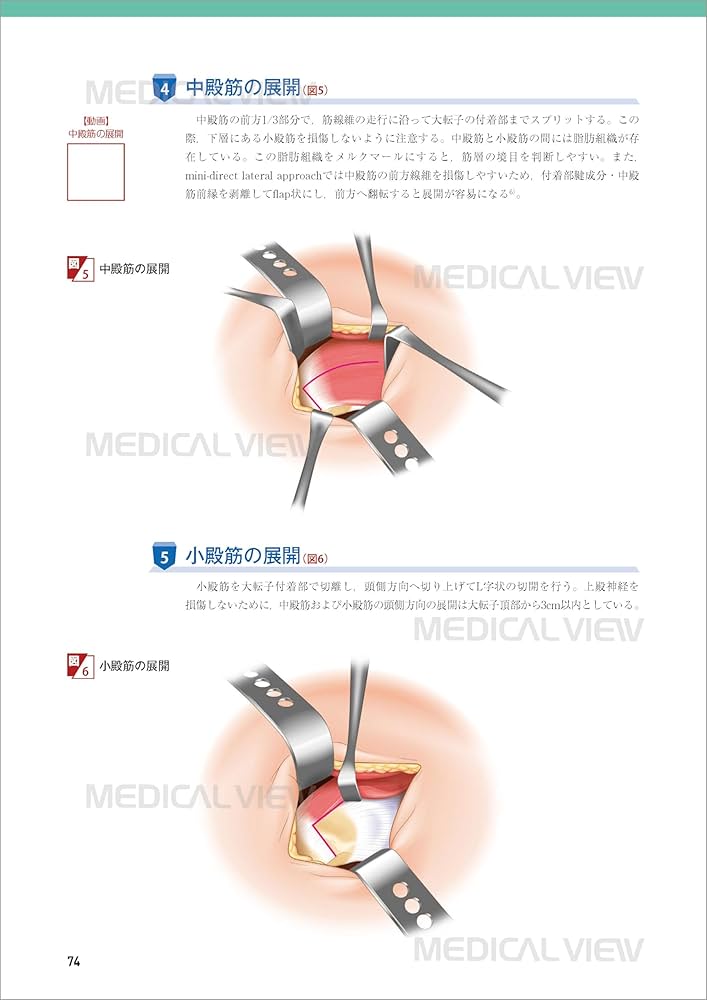 股関節の再建手術［Web動画付］ (新OS NEXUS No.8) | 松田 秀一 |本