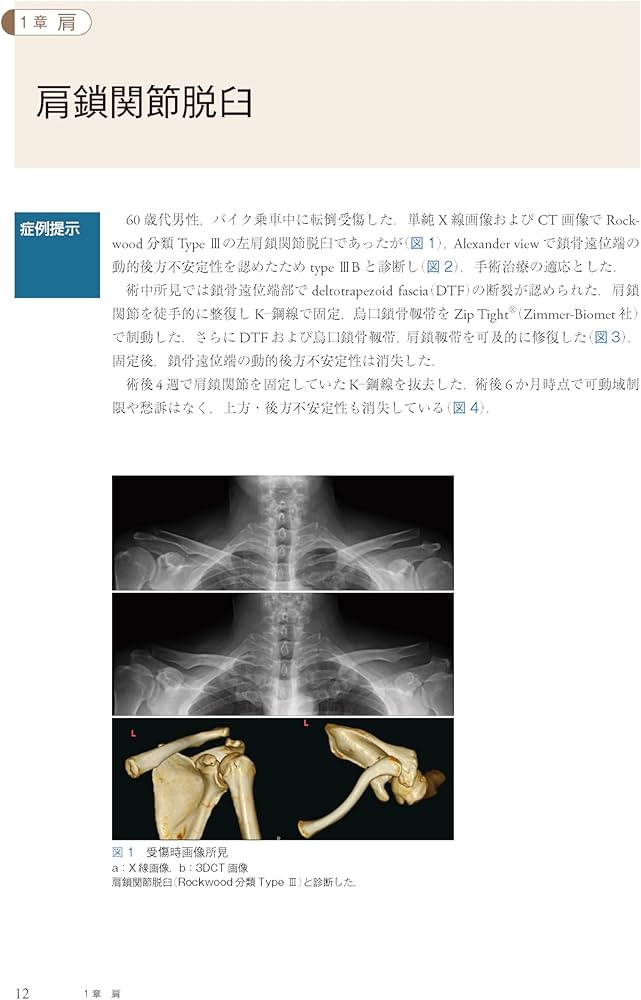 Amazon.co.jp: クリニカル・クエスチョンで考える外傷整形外科ケース