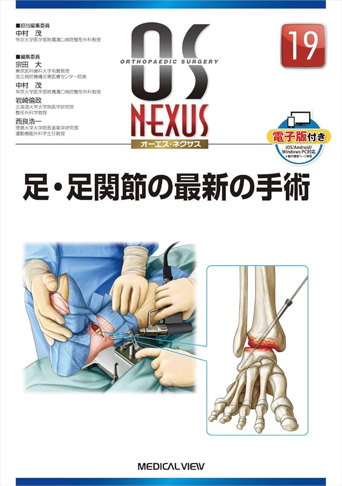 足・足関節の最新の手術 (OS NEXUS(電子版付き) 19) | 中村 茂 |本