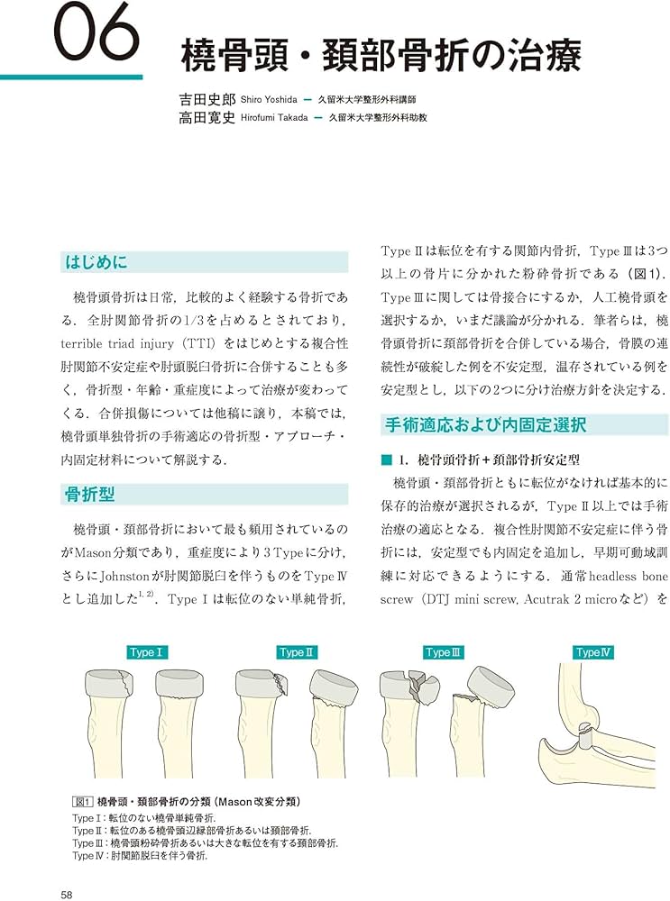 Amazon.co.jp: 肘の外傷:診断・手術・保存療法 (整形外科SURGICAL