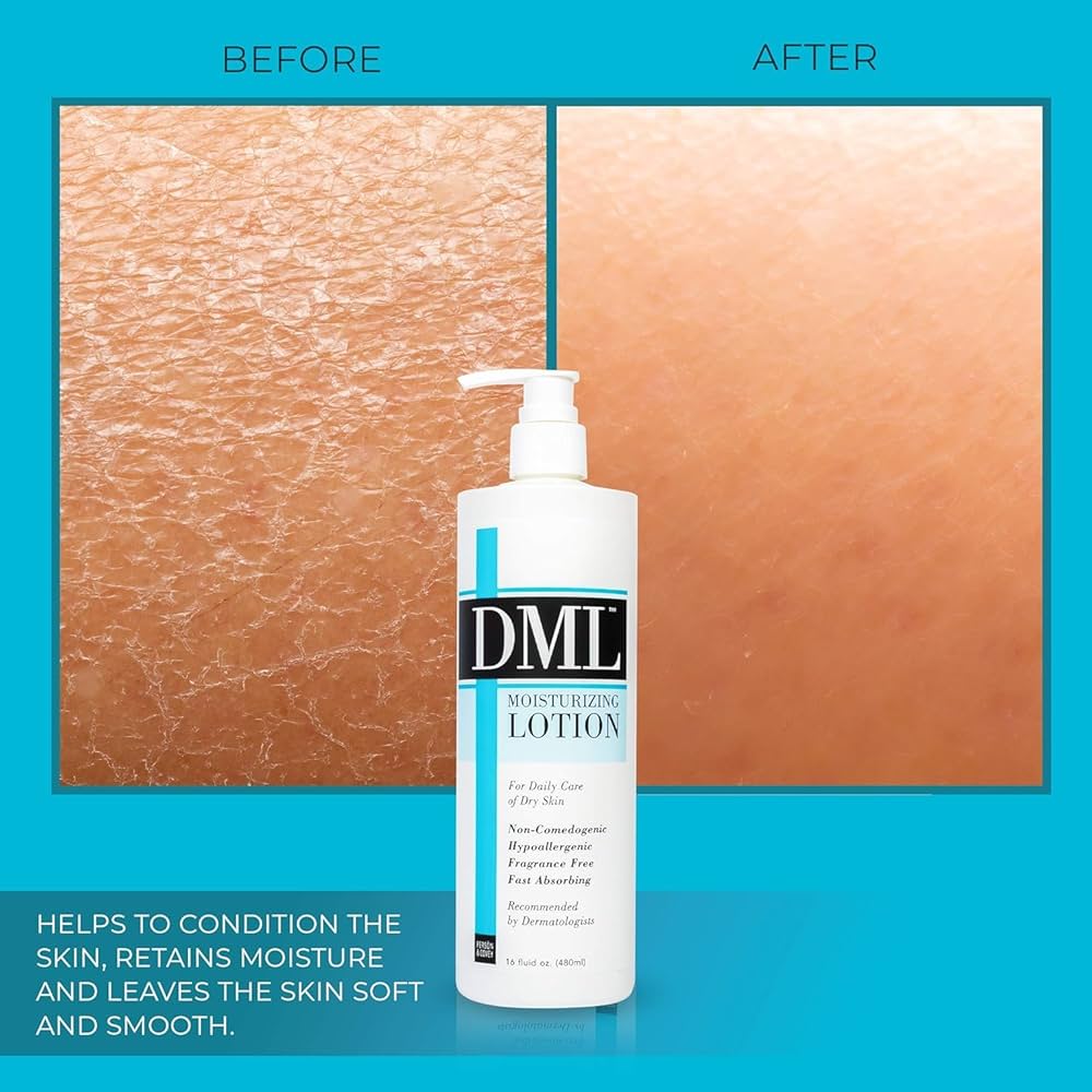 Amazon.com : DML Moisturizing Lotion 16 oz (Pack of 5) : Beauty