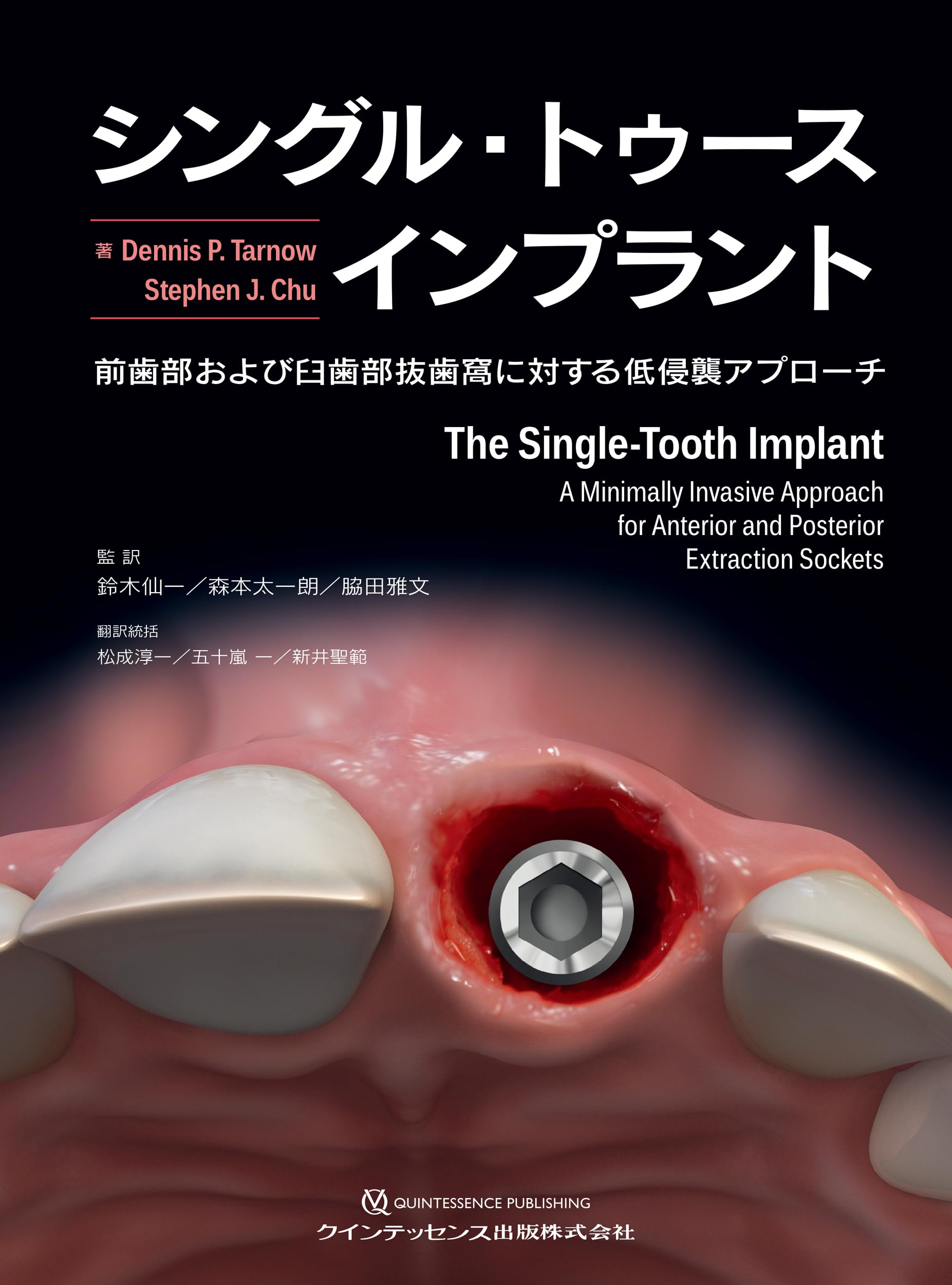 プラクティカル インプラントロジー 口腔インプラント実践臨床