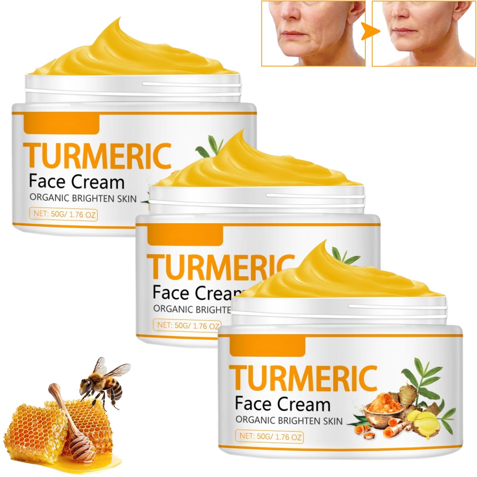 Amazon | ターメリックフェイスクリーム、顔の傷跡用クリーム、顔の