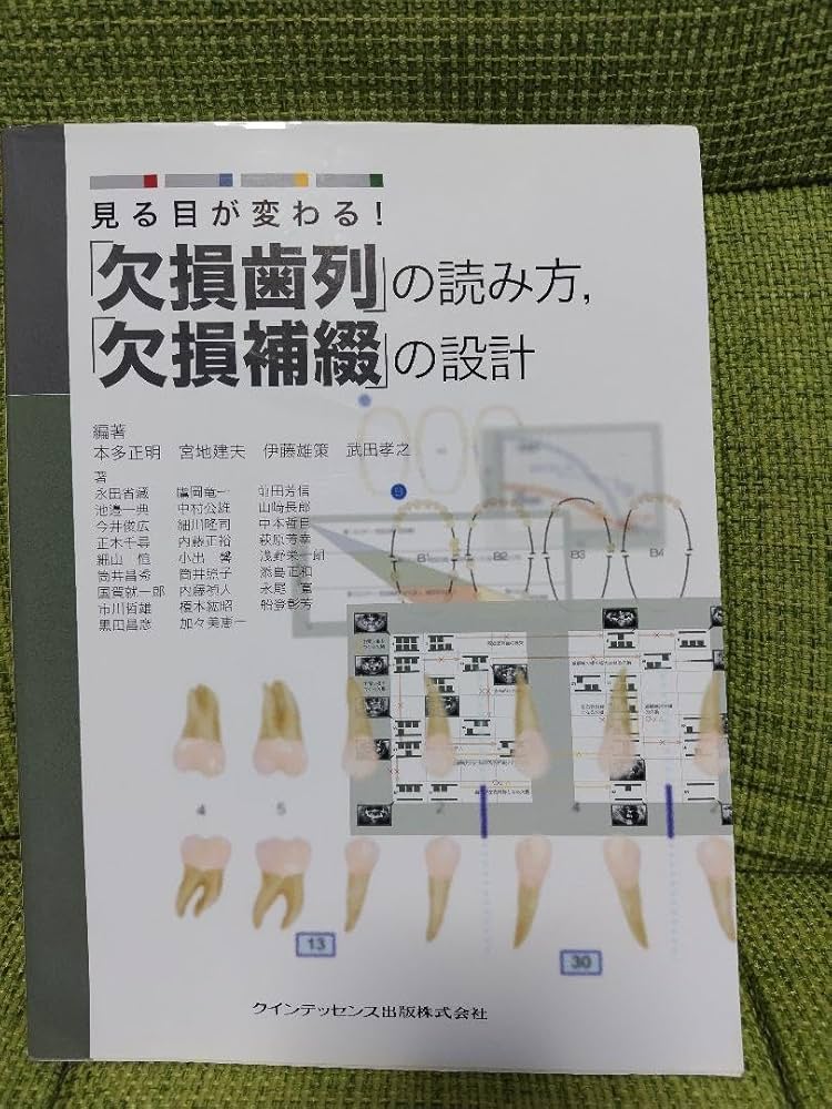Amazon.co.jp: 見る目が変わる!「欠損歯列」の読み方,「欠損補綴」の