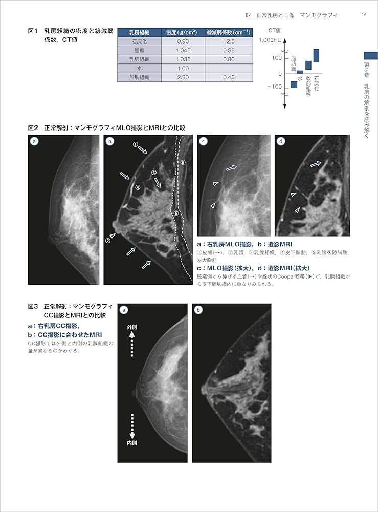 乳房 画像診断の勘ドコロNEO | 角田 博子 |本 | 通販 | Amazon