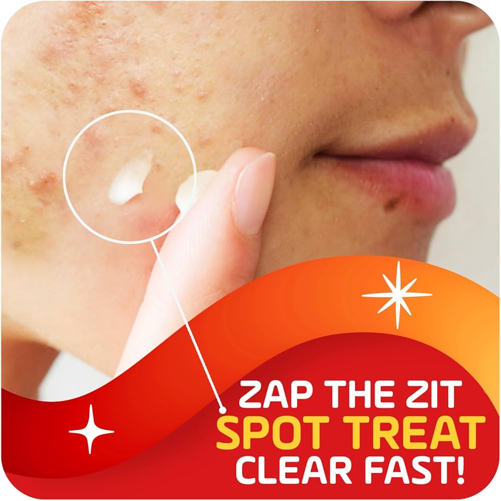 Amazon.com: Asepxia 2% Salicylic Acid Acne Spot Treatment Cream