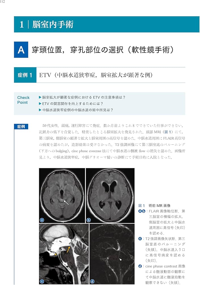 神経内視鏡手術ハンドブック | 永谷 哲也, 村井 尚之, 西山 健一 |本
