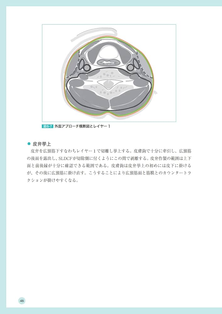 頭頸部がん手術ノート 輪層の外科 | 長谷川 泰久 |本 | 通販 | Amazon