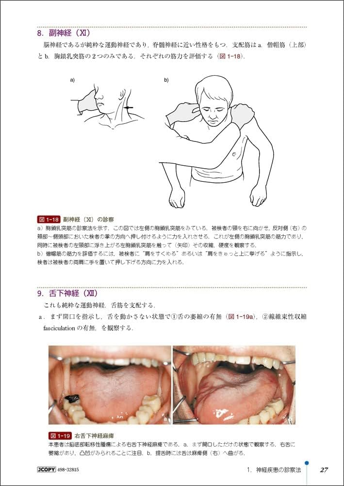 医学生・研修医のための脳神経内科 改訂4版 | 神田 隆 |本 | 通販 | Amazon