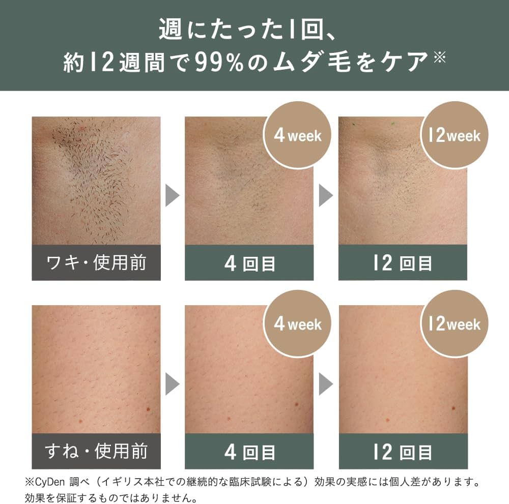 Amazon | スムーズスキン 脱毛器 pure adapt 光美容器 IPL光脱毛器