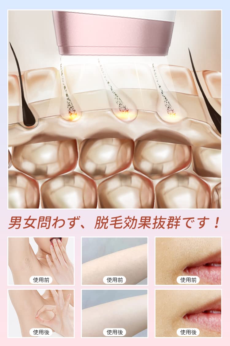 Amazon | 脱毛器 光美容器 冷感脱毛 IPL光脱毛器 全身脱毛 家庭用 男女