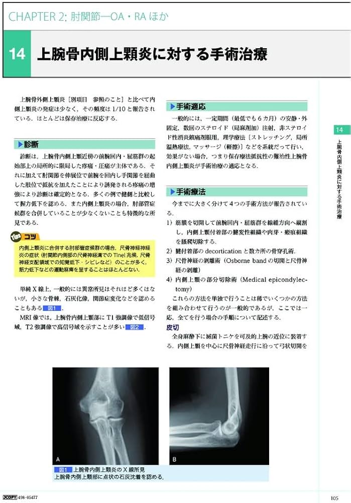 手の外科―私のアプローチ 第2版 | 三浪 明男 |本 | 通販 | Amazon