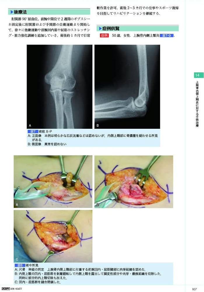 手の外科―私のアプローチ 第2版 | 三浪 明男 |本 | 通販 | Amazon